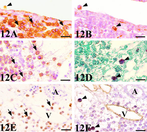 Fig. 12