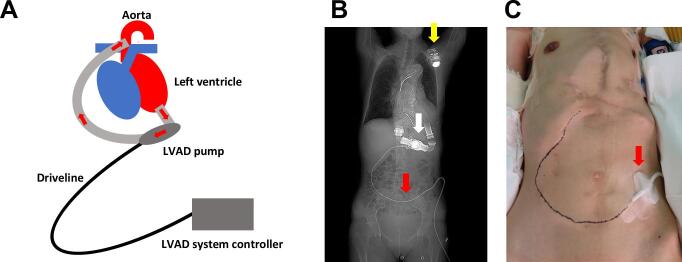 Fig. 1