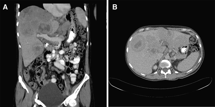 Fig. 1