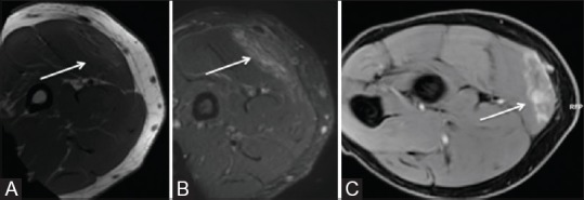 Figure 1(A-C)