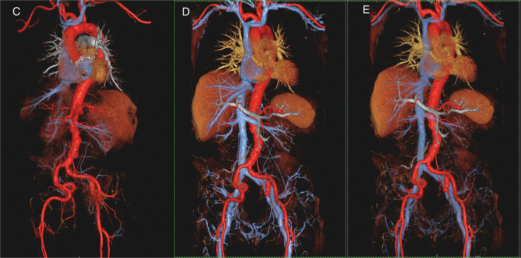 Figure1 (A-E)