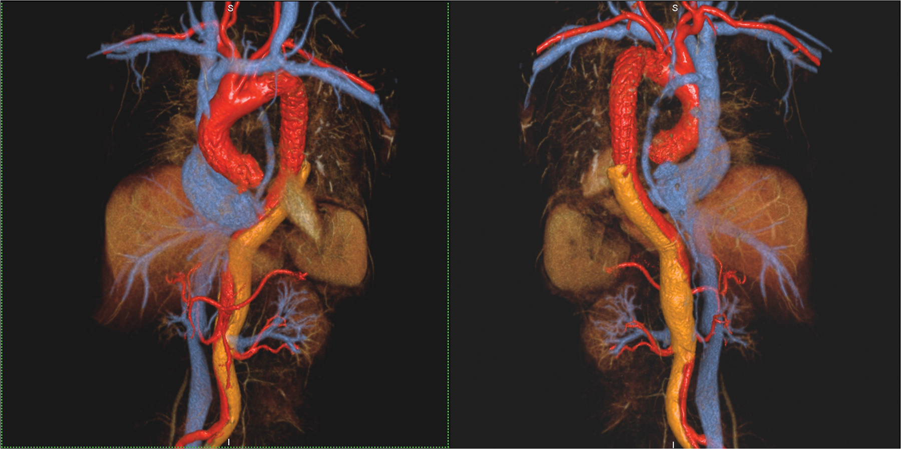 Figure 2 (A-C)