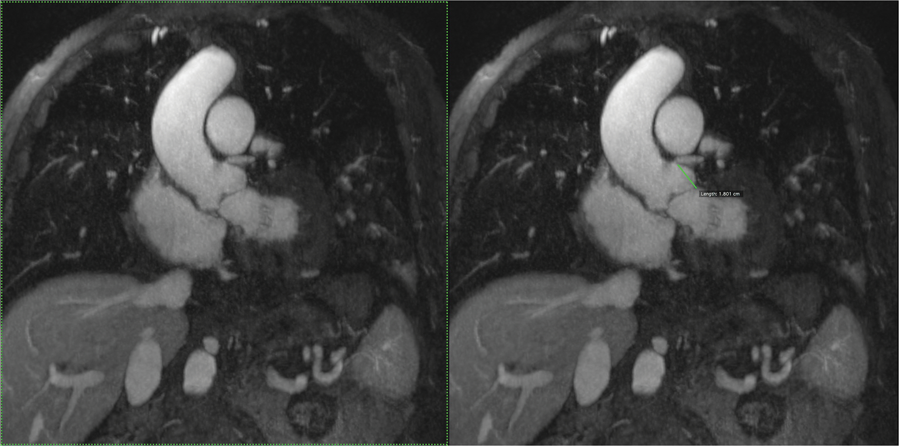 Figure 4 (A,B)