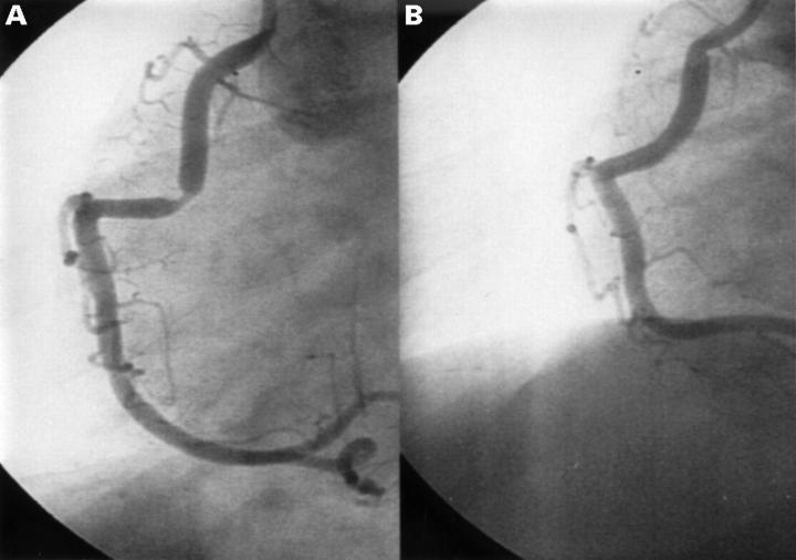 Figure 2  