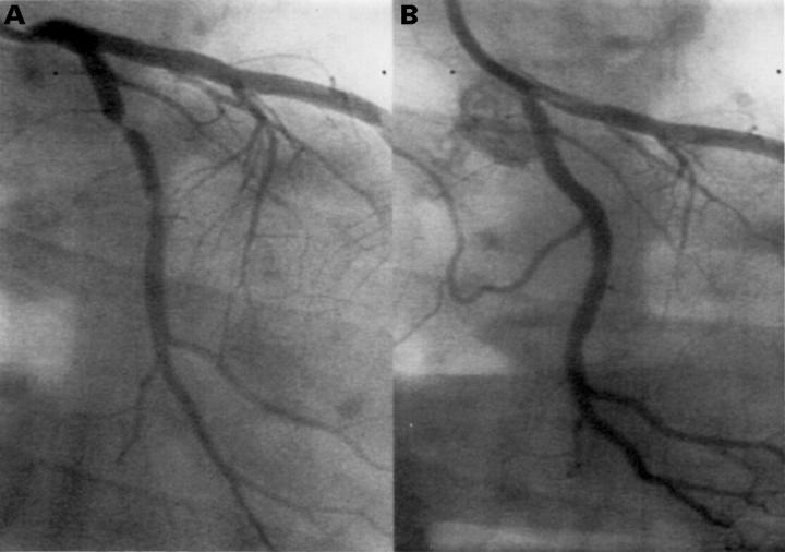 Figure 1  