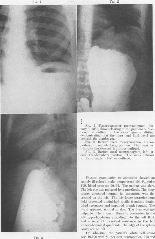 Fig. 1., Fig. 2., Fig. 3.