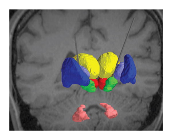 FIG. 2