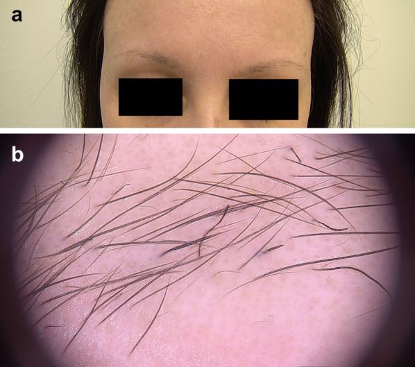 Fig. 7