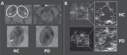 Fig.1
