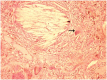[Table/Fig-8]: