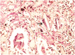 [Table/Fig-9]: