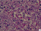[Table/Fig-6b]: