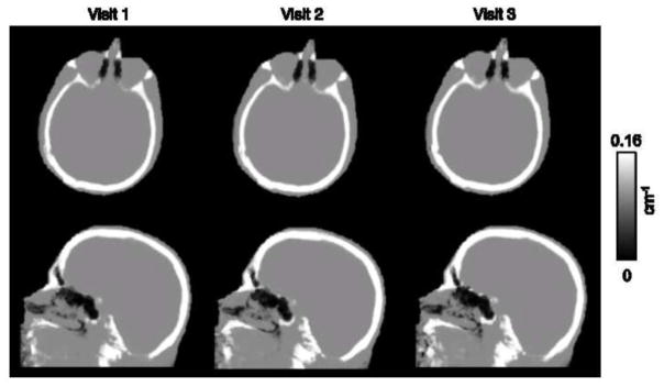 Fig 6