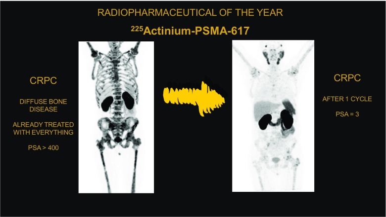 Fig. 14