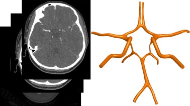 Fig. 1