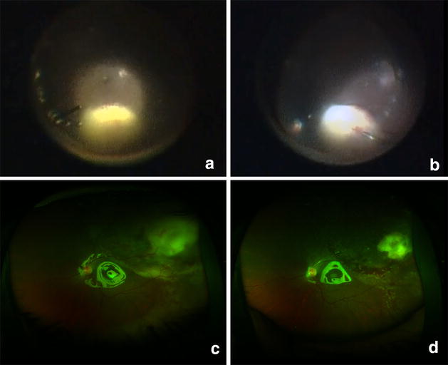 Fig. 1