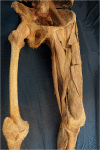 Fig 3