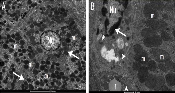 Figure 2A&B: