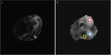 Fig 2.