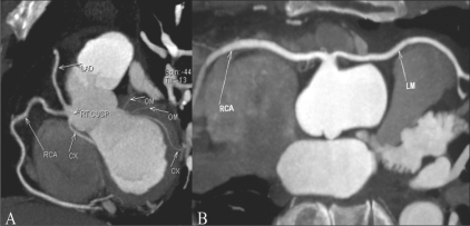 Figure 6 (A, B)