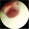 Fig. (2)
