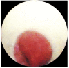 Fig. (3)
