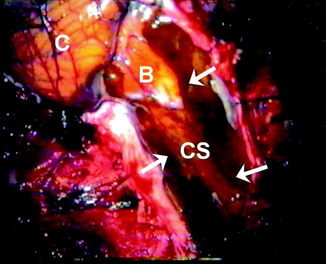 Fig 3.