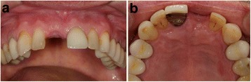 Fig. 13