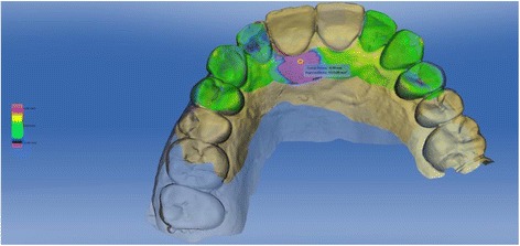 Fig. 20