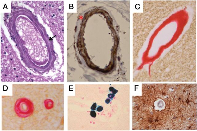 Fig 3.