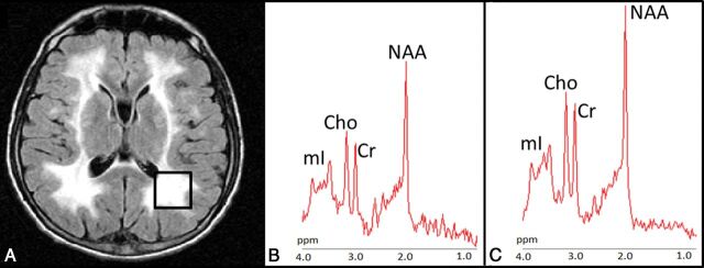 Fig 2.