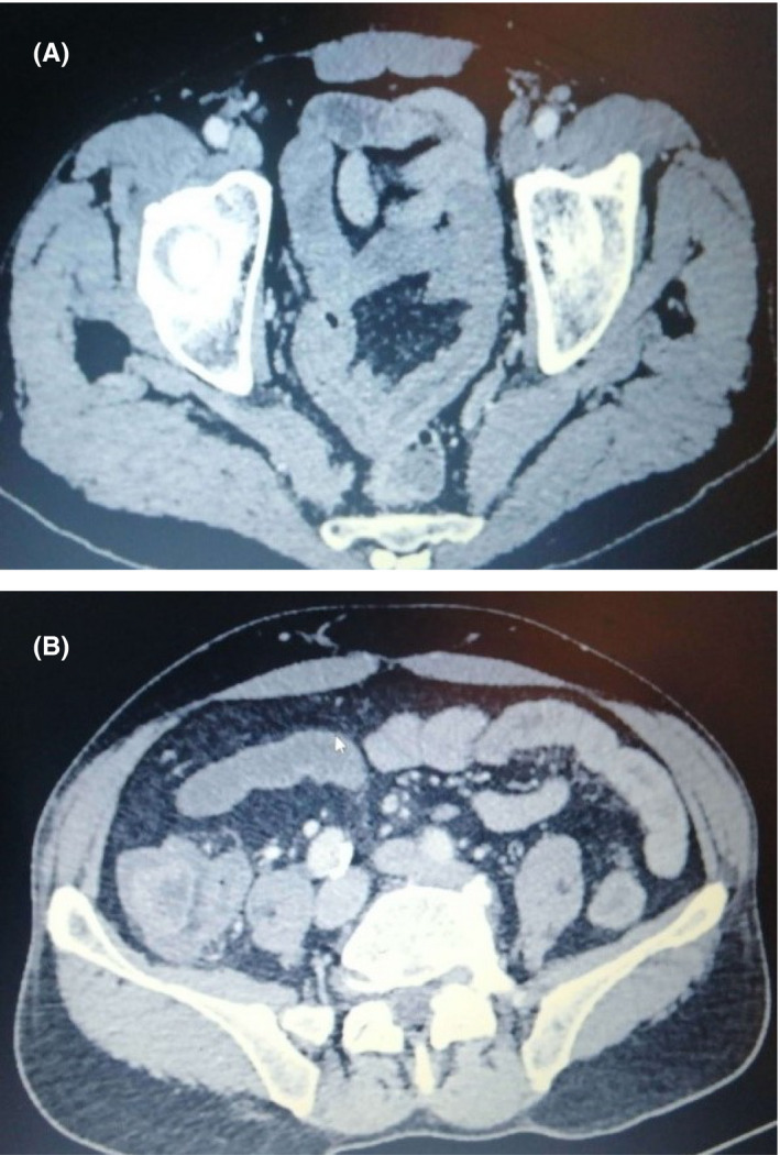 FIGURE 1