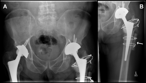 Figure 3: