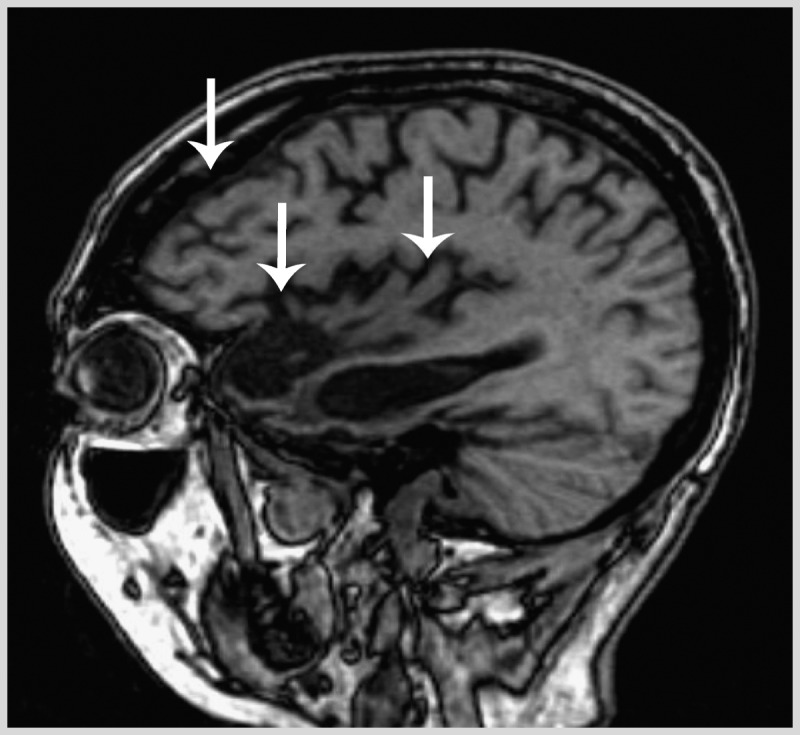 Figure 1-2