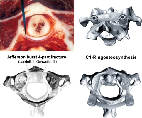 Fig. 1