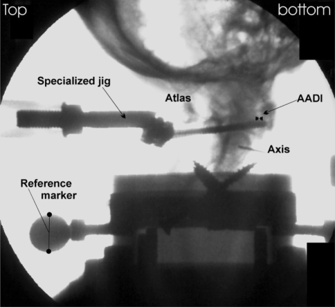 Fig. 2