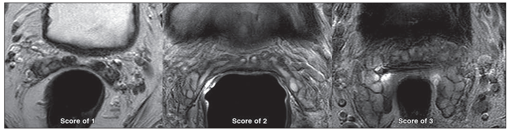 Fig. 2—