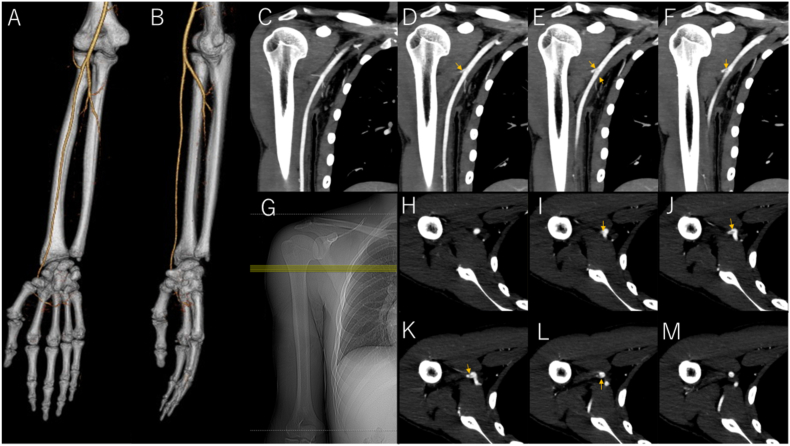 Fig. 3