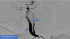 Fig 1 –