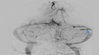 Fig 5 –