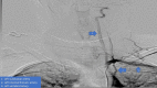 Fig 4 –