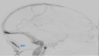 Fig 6 –