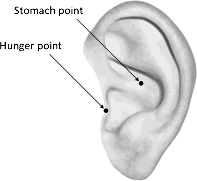 Figure 1