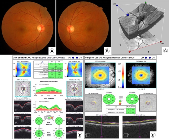 FIG. 1