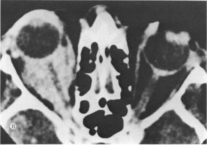 FIGURE 11 B