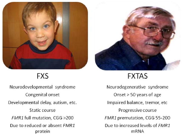 Fragile X-associated Tremor/Ataxia Syndrome (FXTAS): Clinical Phenotype ...