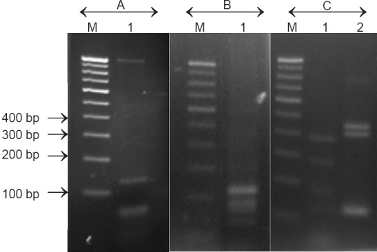 Fig. 2B