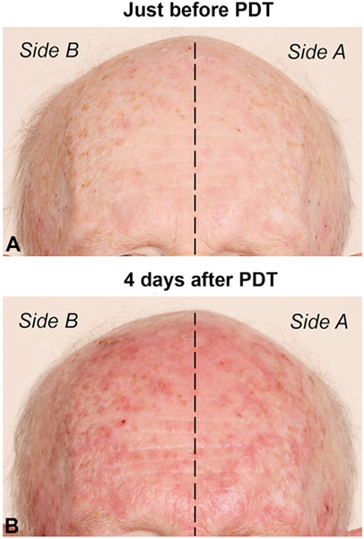 Fig 2.