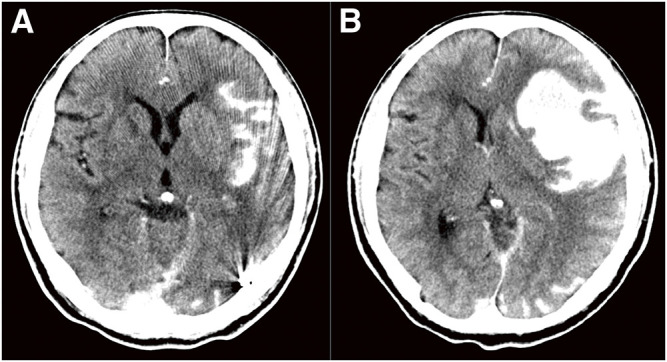 Fig. 6