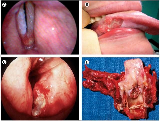 Figure 3: